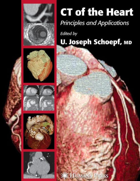 CT of the Heart: Principles and Applications / Edition 1