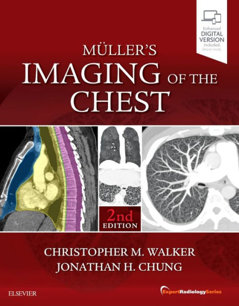 Muller's Imaging of the Chest: Expert Radiology Series / Edition 2